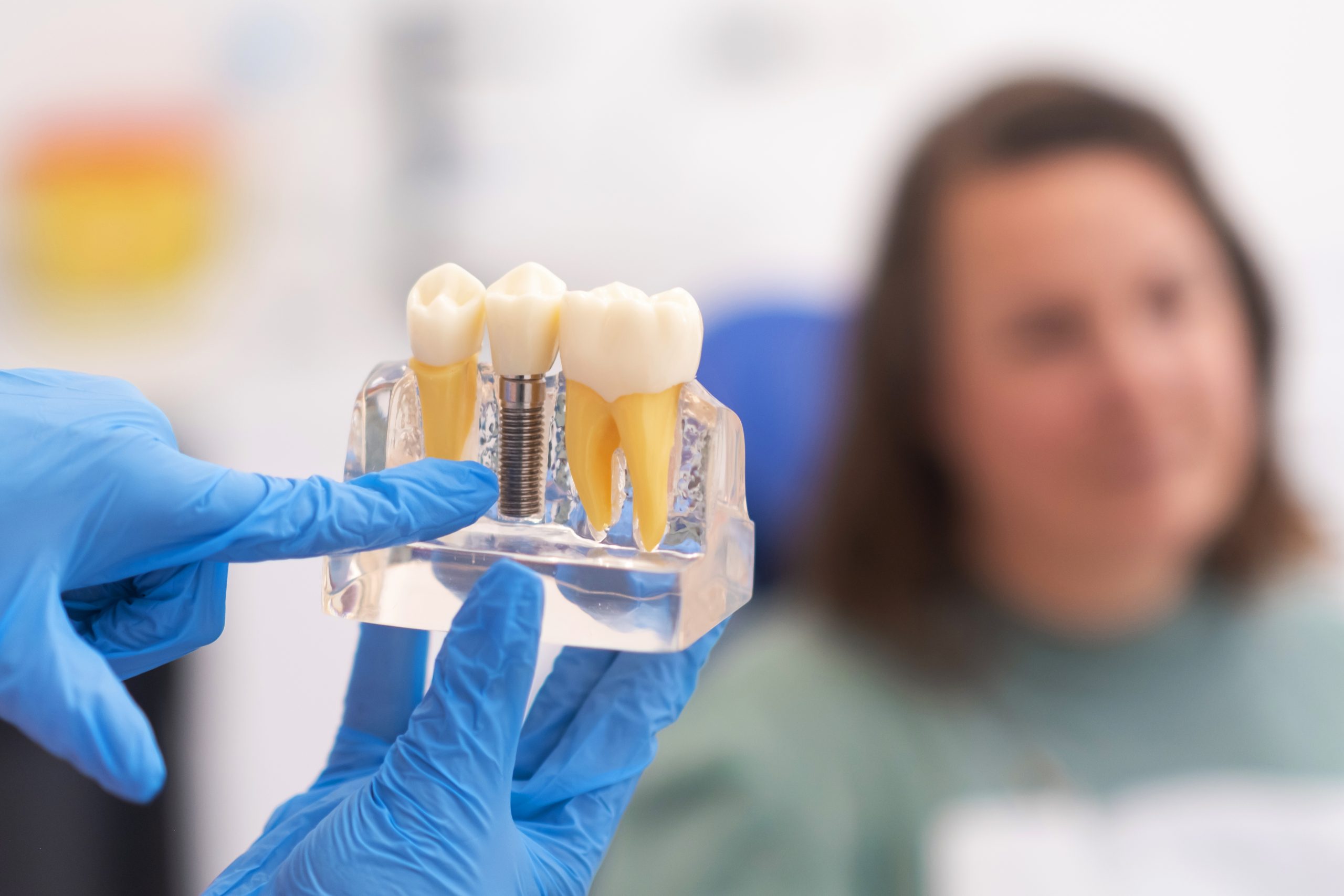 dental implants pontypridd​